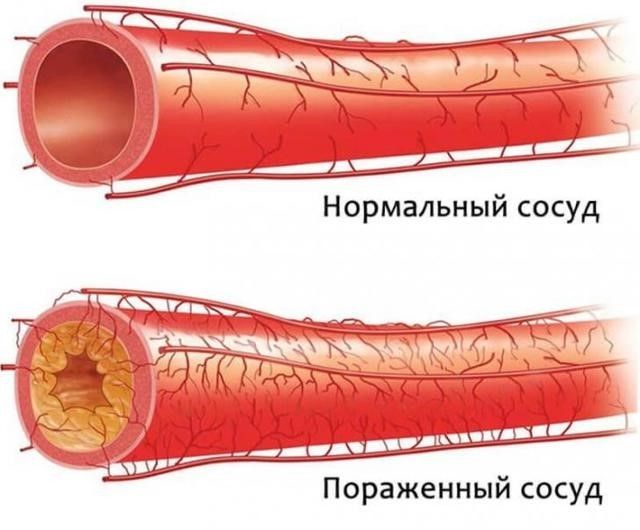 сосуд.jpg