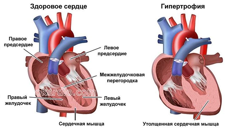 сердце.jpg